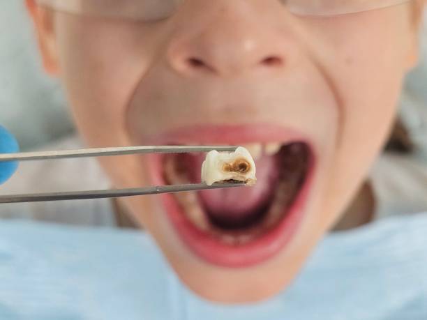 Best Emergency Dentist for Knocked-Out Tooth in Charles Town, WV