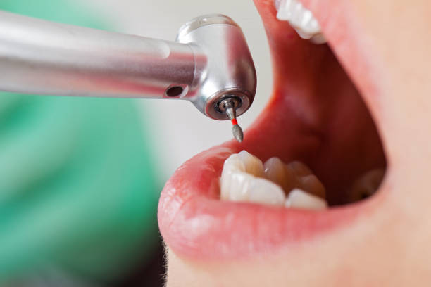 Best Emergency Root Canal Treatment in Charles Town, WV